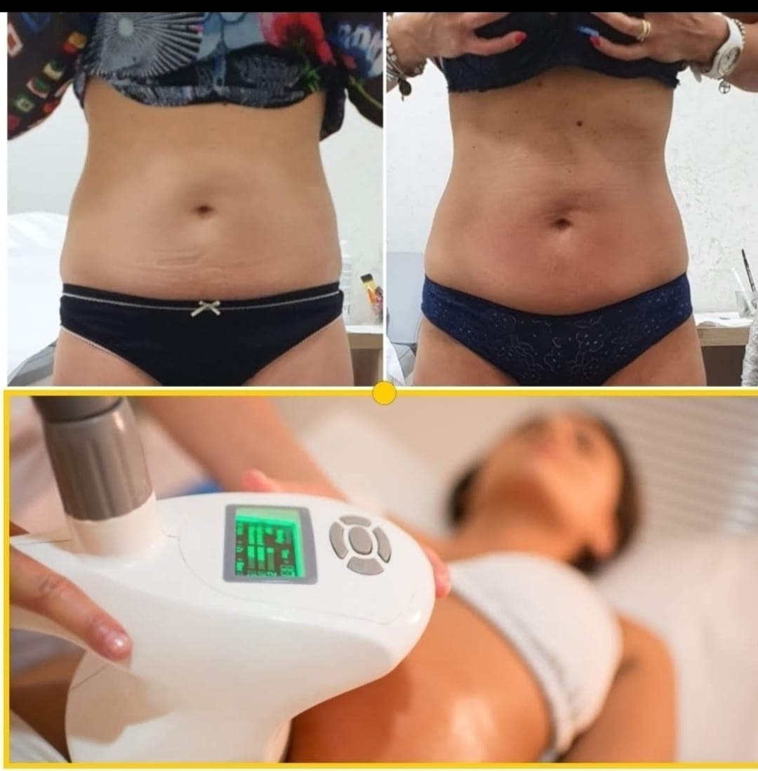 Hy Shape - Risultati